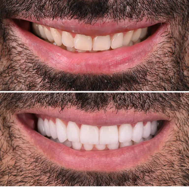 Common Dental Issues Common Dental Issues